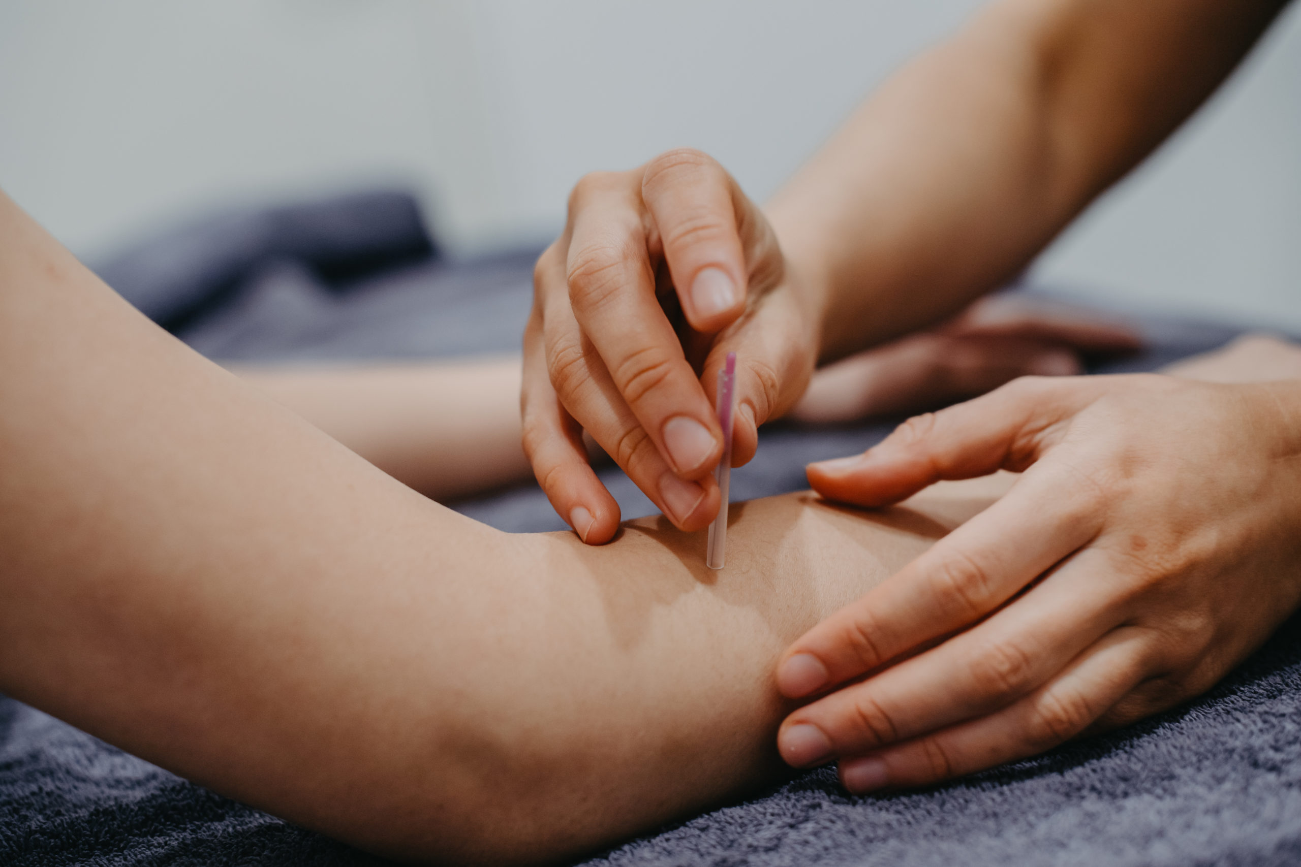 Dry Needling Ringwood North